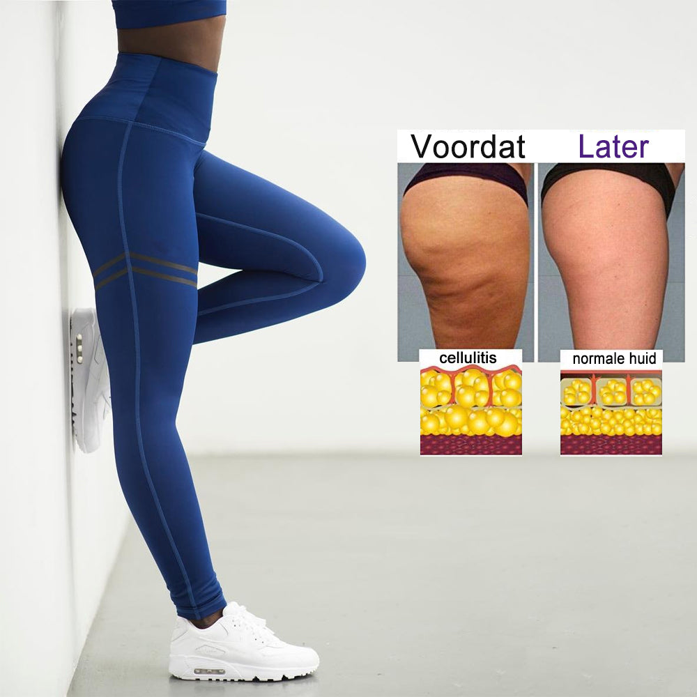 WW | Cellulite Kompressionsleggings für Frauen
